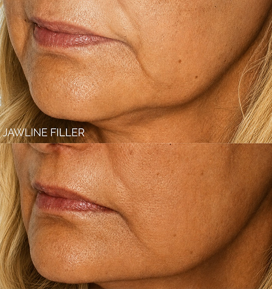 close-up images of pink lips showcasing various angles for beauty enhancement tips on lip care and lip treatments 9 benefits for fuller lips